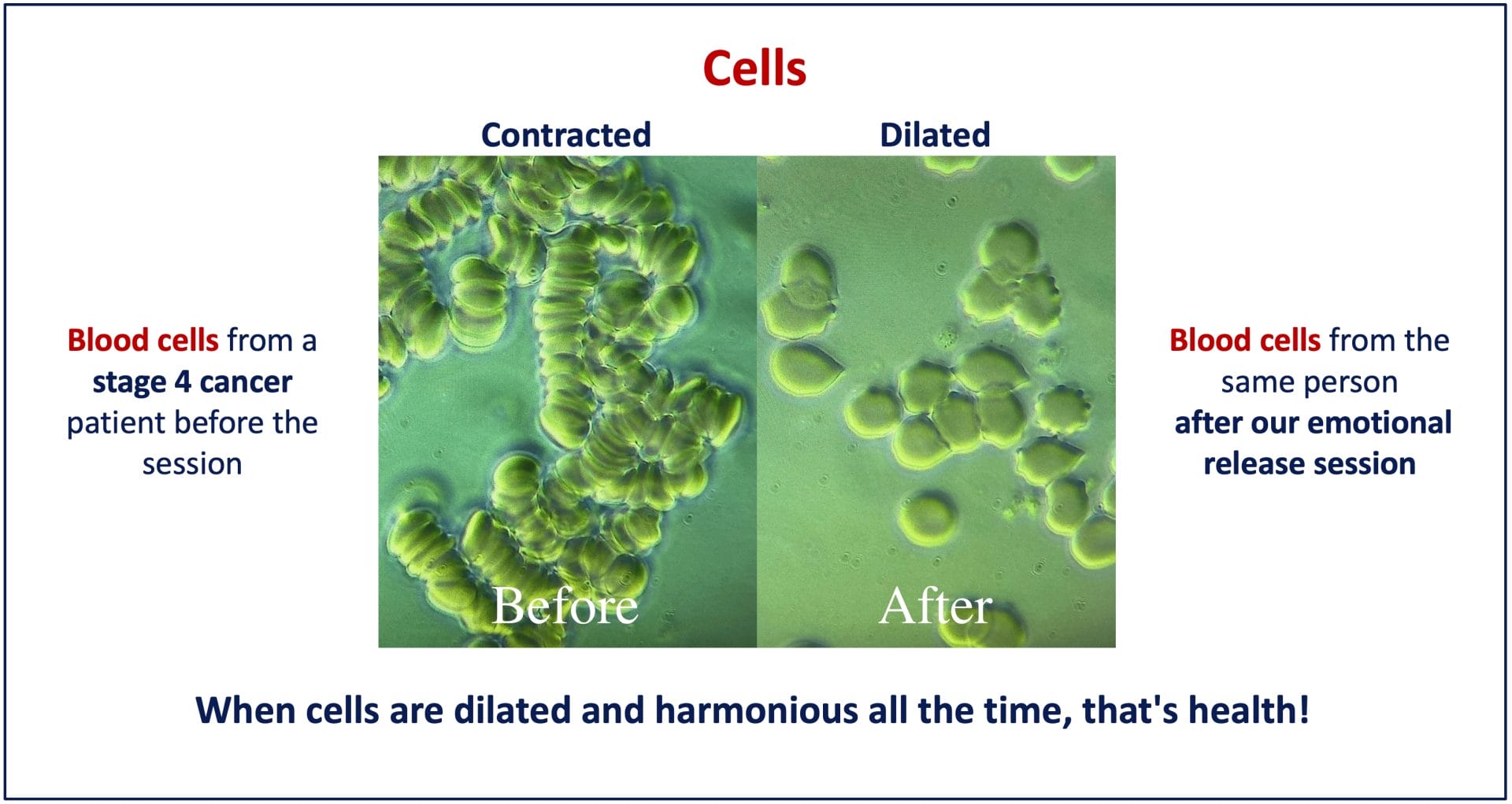 Blood cell 2025_en - Arushiom Foundation
